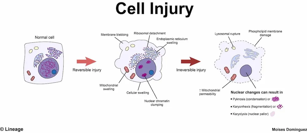 Cell Injury