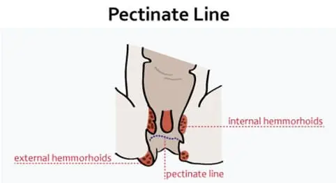 Pectinate Line