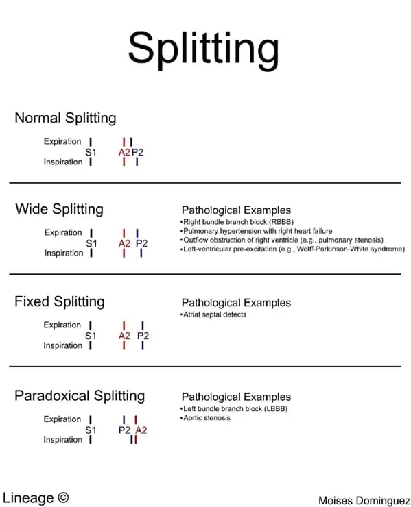 Splitting