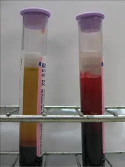 Transfusion